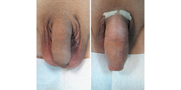 arată penisuri în stare de erecție)